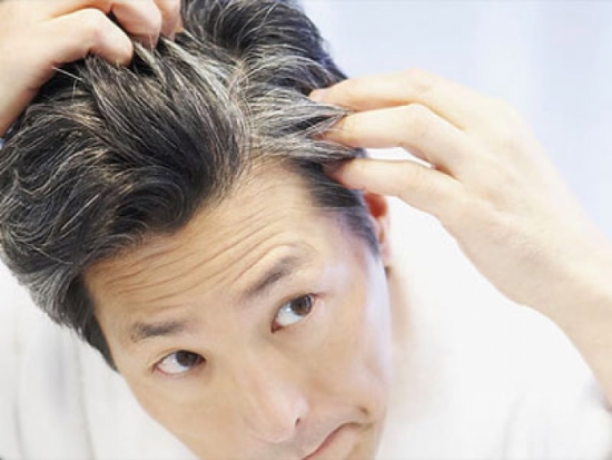 Nguyên nhân và cách điều trị chứng tóc bạc sớm